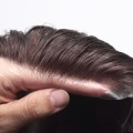 Tupet męski na mikroskórze - newhairstories.pl