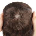 Tupet męski na mikroskórze - newhairstories.pl